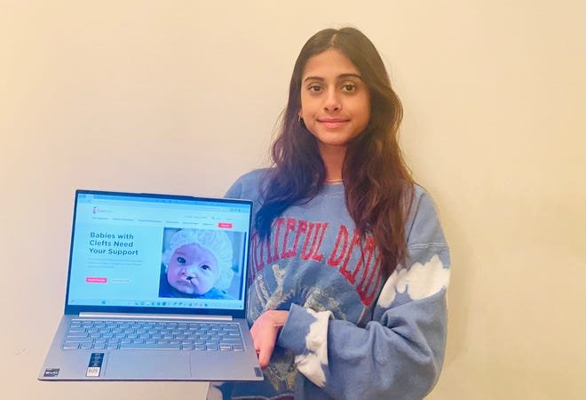 Northville student raising funds for cleft surgeries after India trip – Travel India Alone